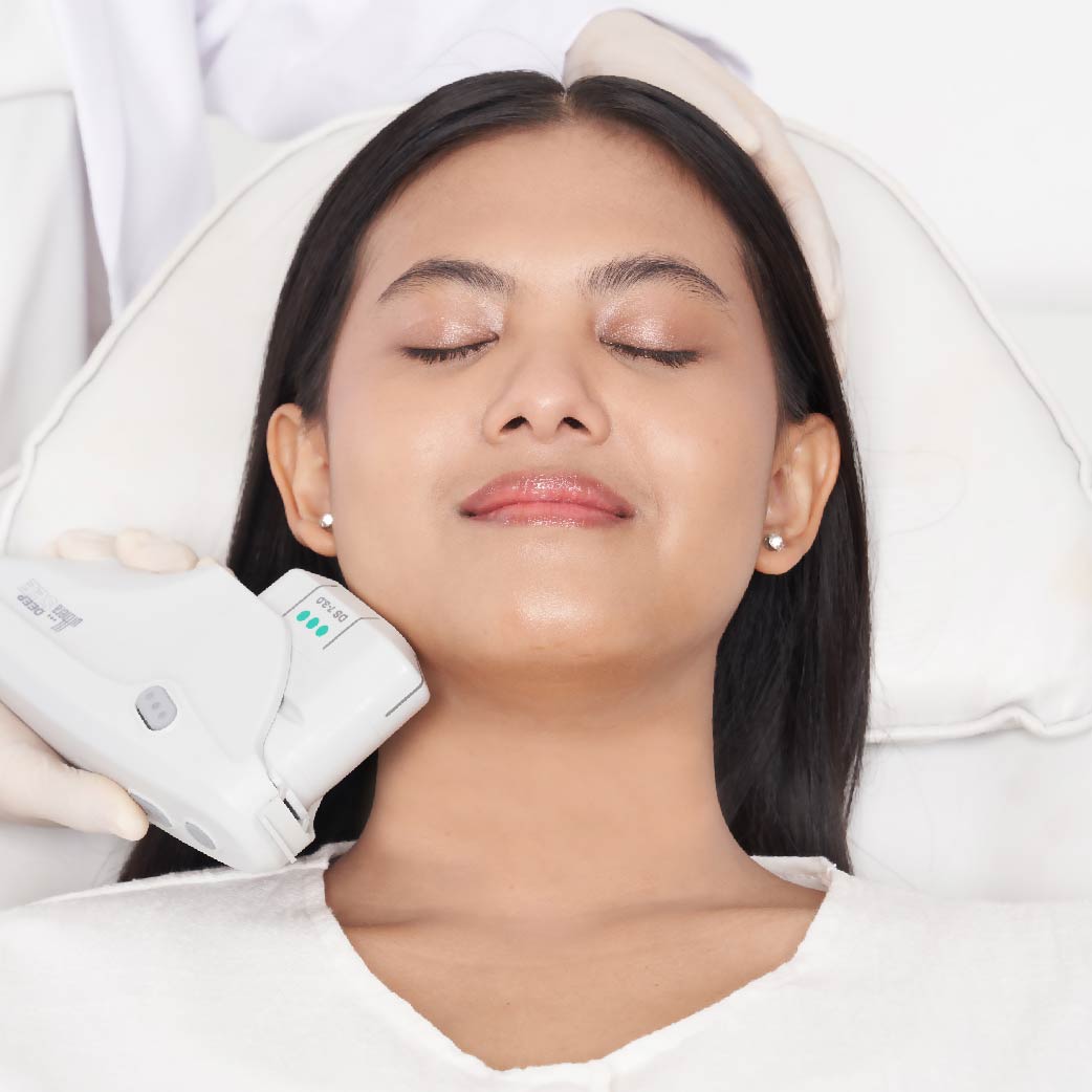 Image Skin Tightening Therapy by Ulthera for Jawline & Neck